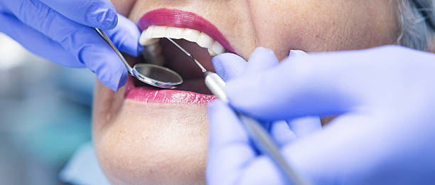 Best Emergency Treatment for Dental Infections or Abscesses in Montecito, CA